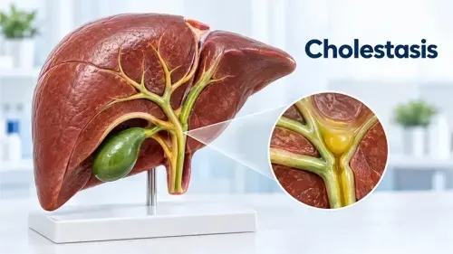 Cholestasis